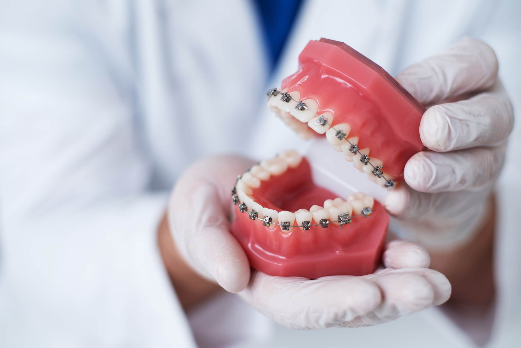 Doctor Koen shows how the system of braces on teeth is arranged