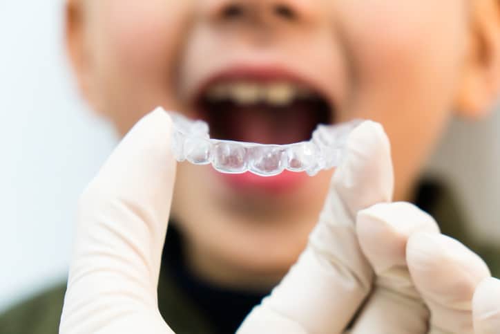 doctor holding a clear aligner in front of a child’s open mouth