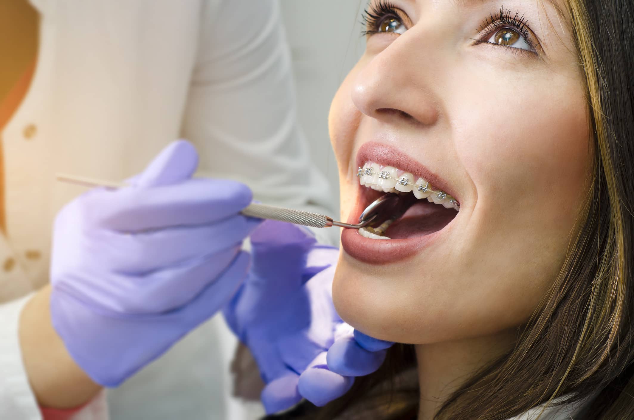 Relieved woman smiling after receiving emergency orthodontic treatment (empty alt-attribute)