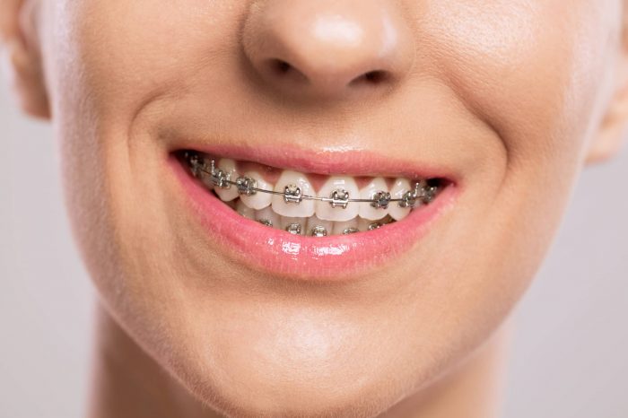 A close up of a girl with braces.
