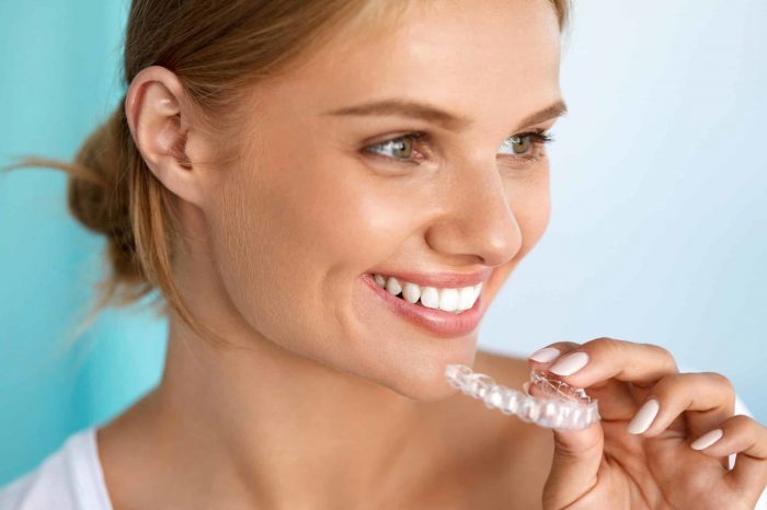 a woman holding her invisible retainer used for teeth whitening