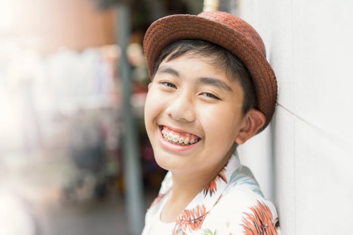 Asia,Teenager,With,Teeth,Brace,Dental,Smiling,And,Happy,For