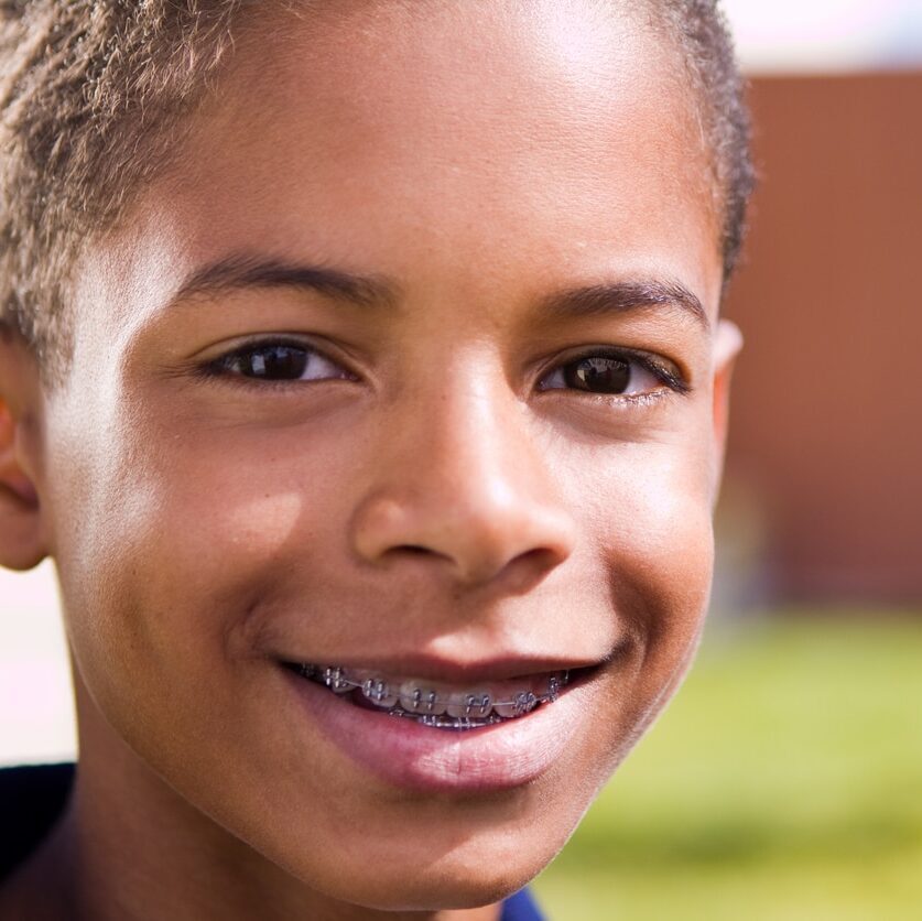 Young child undergoing early orthodontic treatment with braces