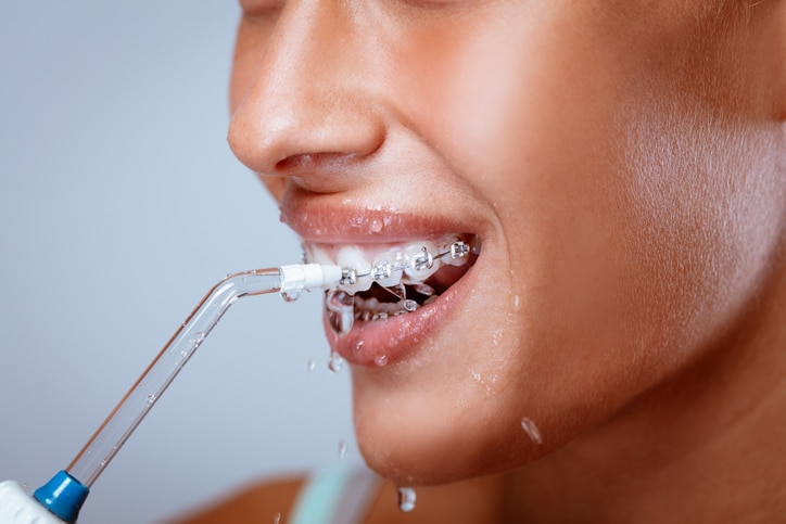 Profile of a girl with braces using a water flossers